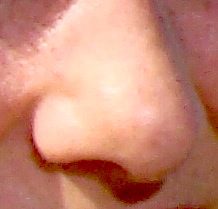 nez